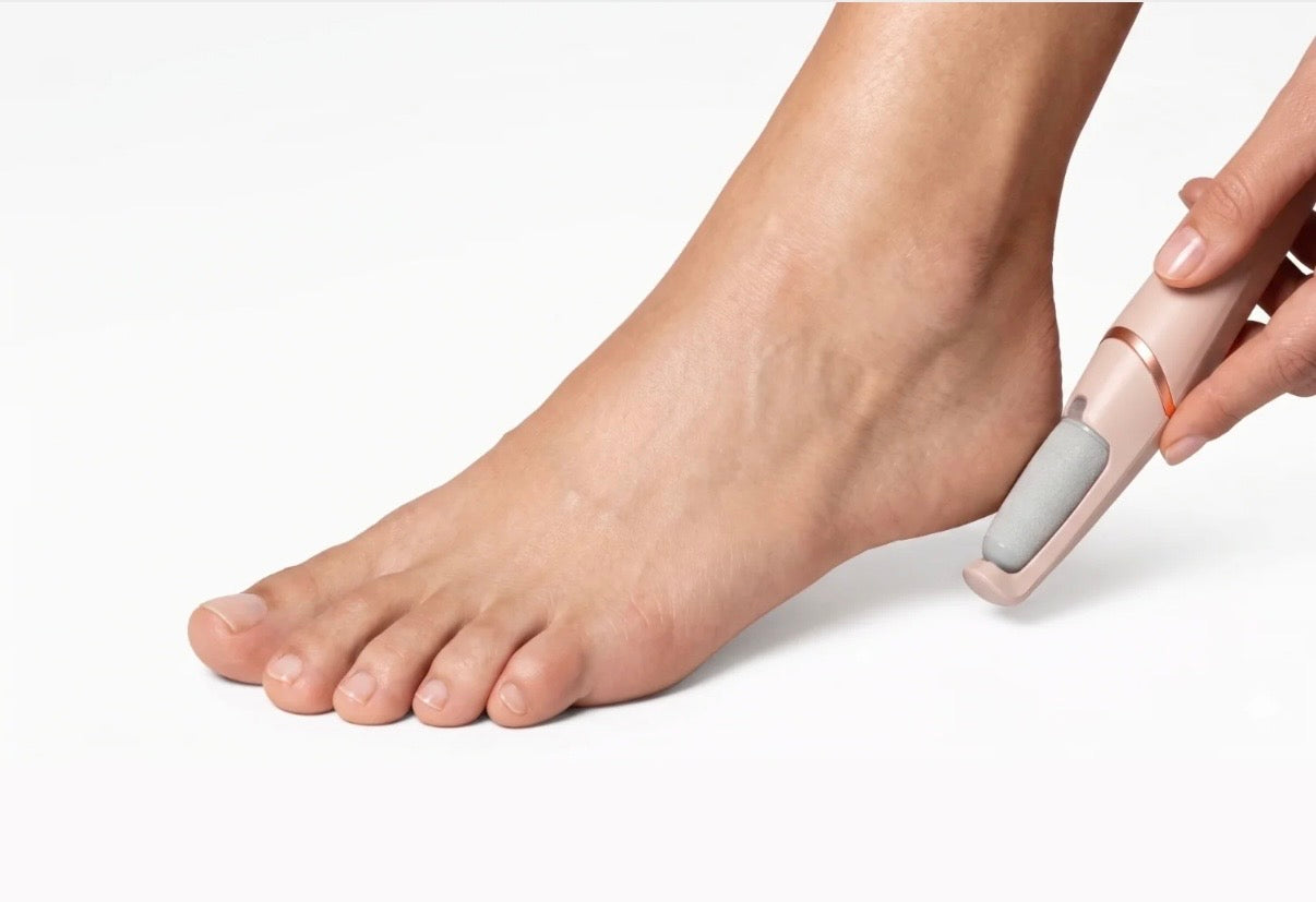 SoleGlow™ Pro Callus Remover