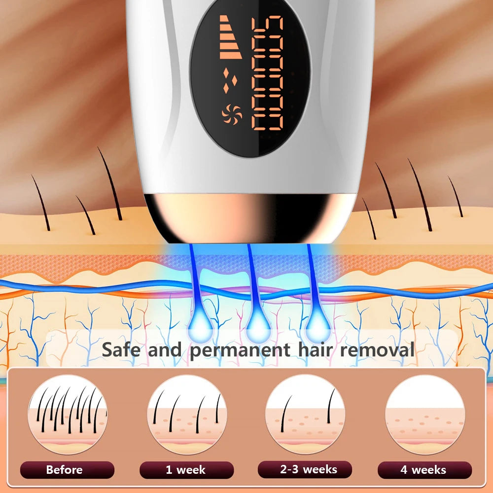 Ovira IPL™ Hair Removal Device
