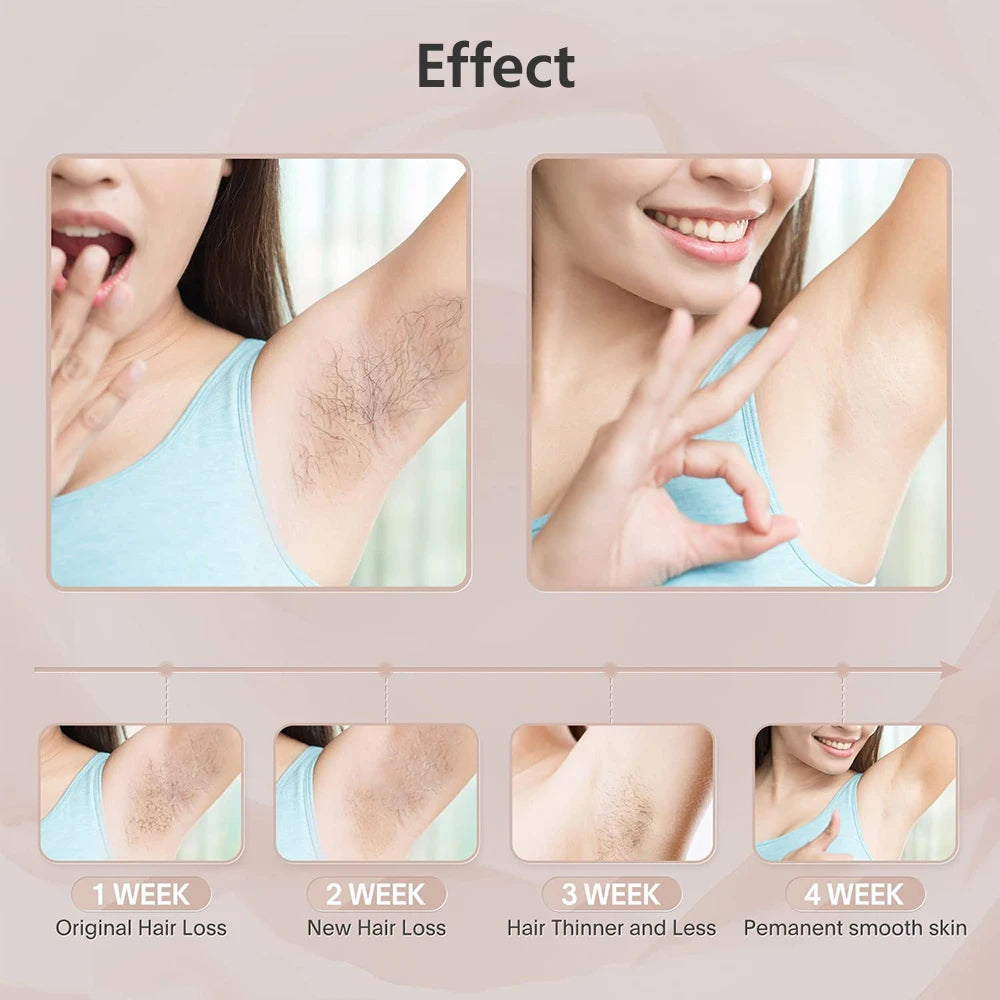 Ovira IPL™ Hair Removal Device