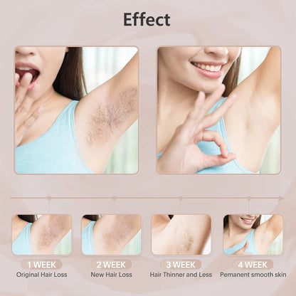 Ovira IPL™ Hair Removal Device